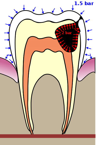Teeth graphics